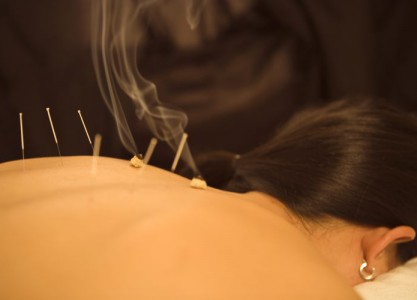 Traditionelle chinesische Medizin: Akupunktur